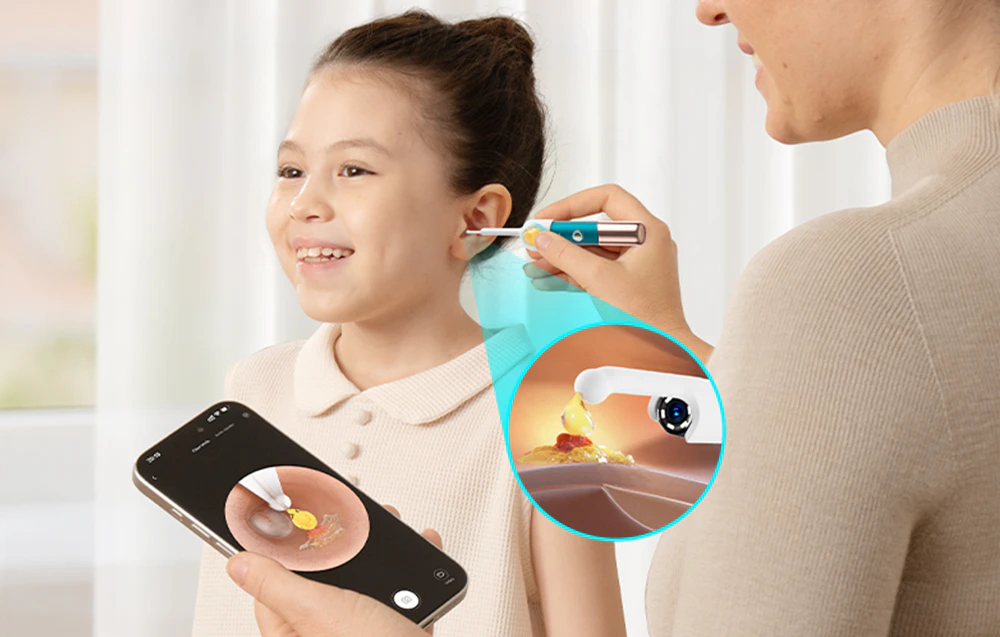 O femeie îndepărtează ceara din urechea unui copil folosind un dispozitiv cu cameră; vedere de aproape și previzualizare în aplicație
